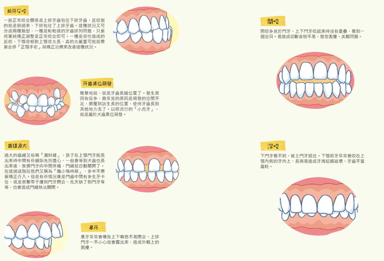 teeth01